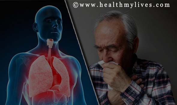 sintomas ng COPD